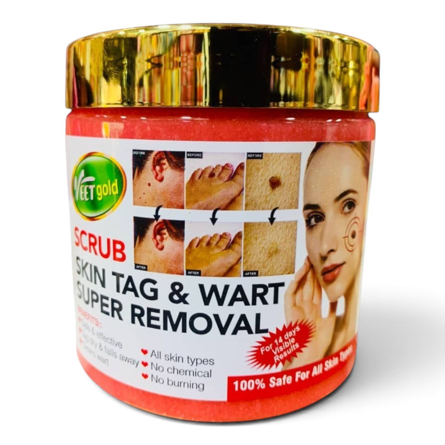 Veet Gold Skin Tag & Wart Removal Scrub